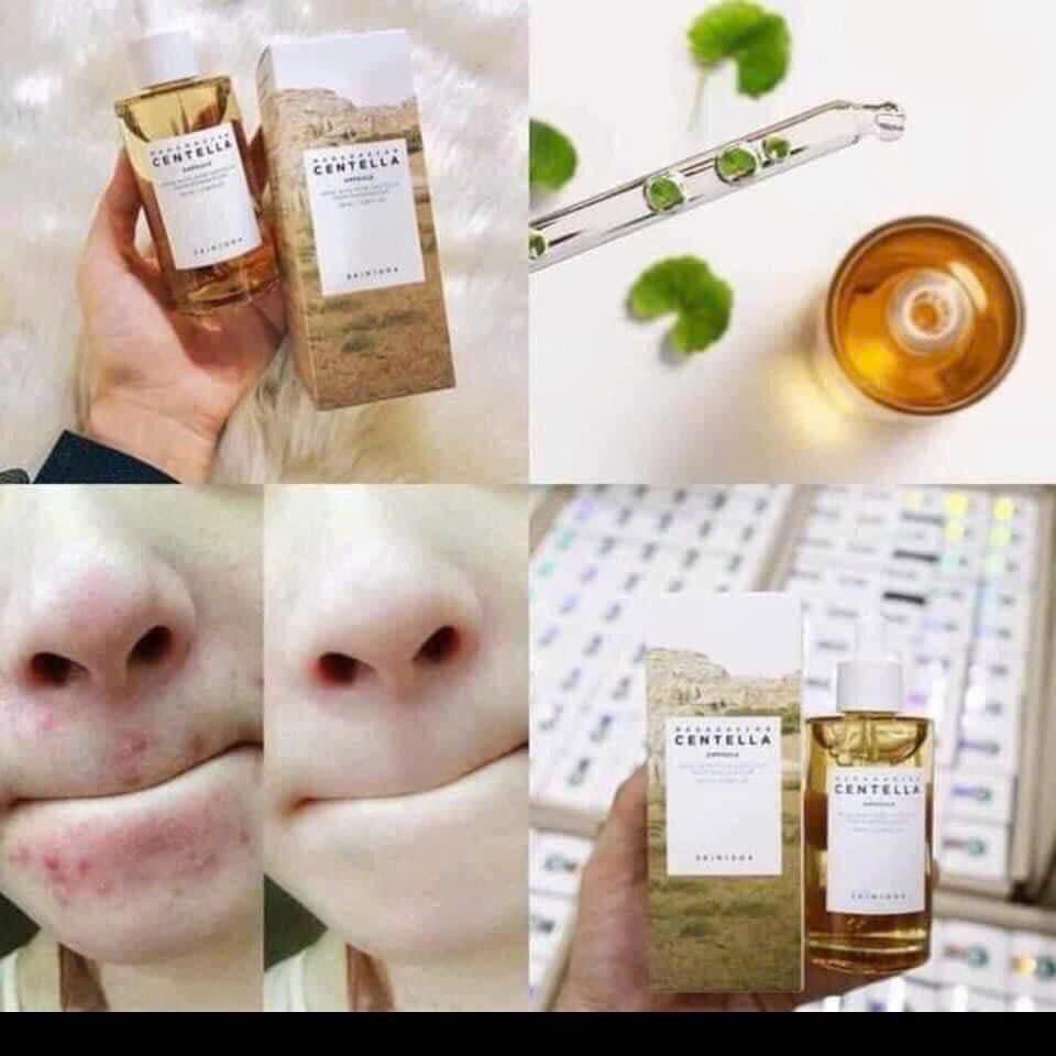 Bộ Dưỡng Da Chiết Xuất Từ Rau Má SKIN1004 MADAGASCAR CENTELLA TRAVEL KIT 2